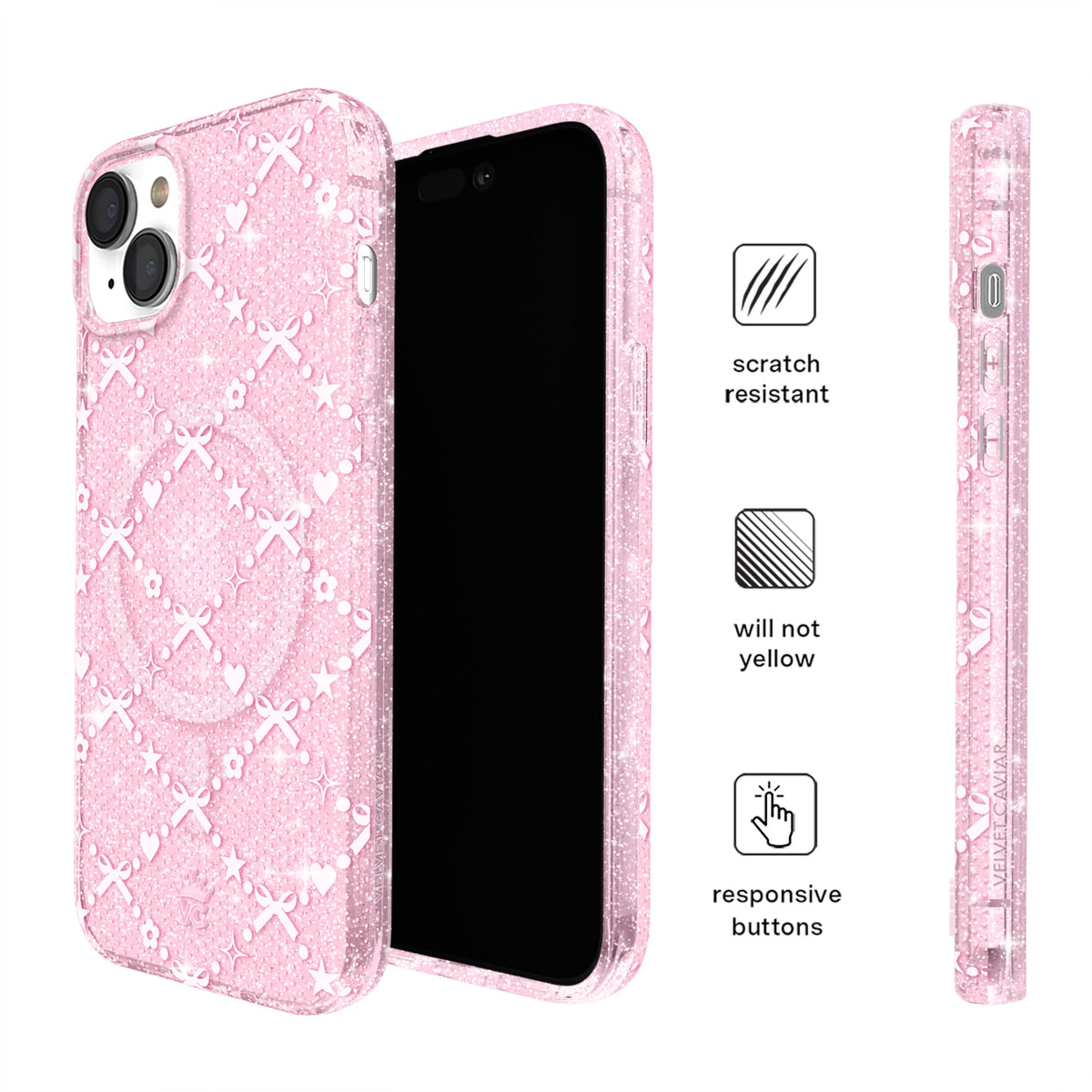 Sugar Baby Glitter iPhone Case