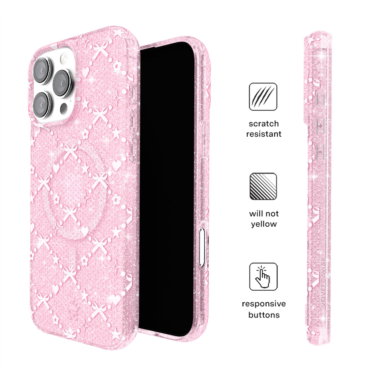 Sugar Baby Glitter iPhone Case