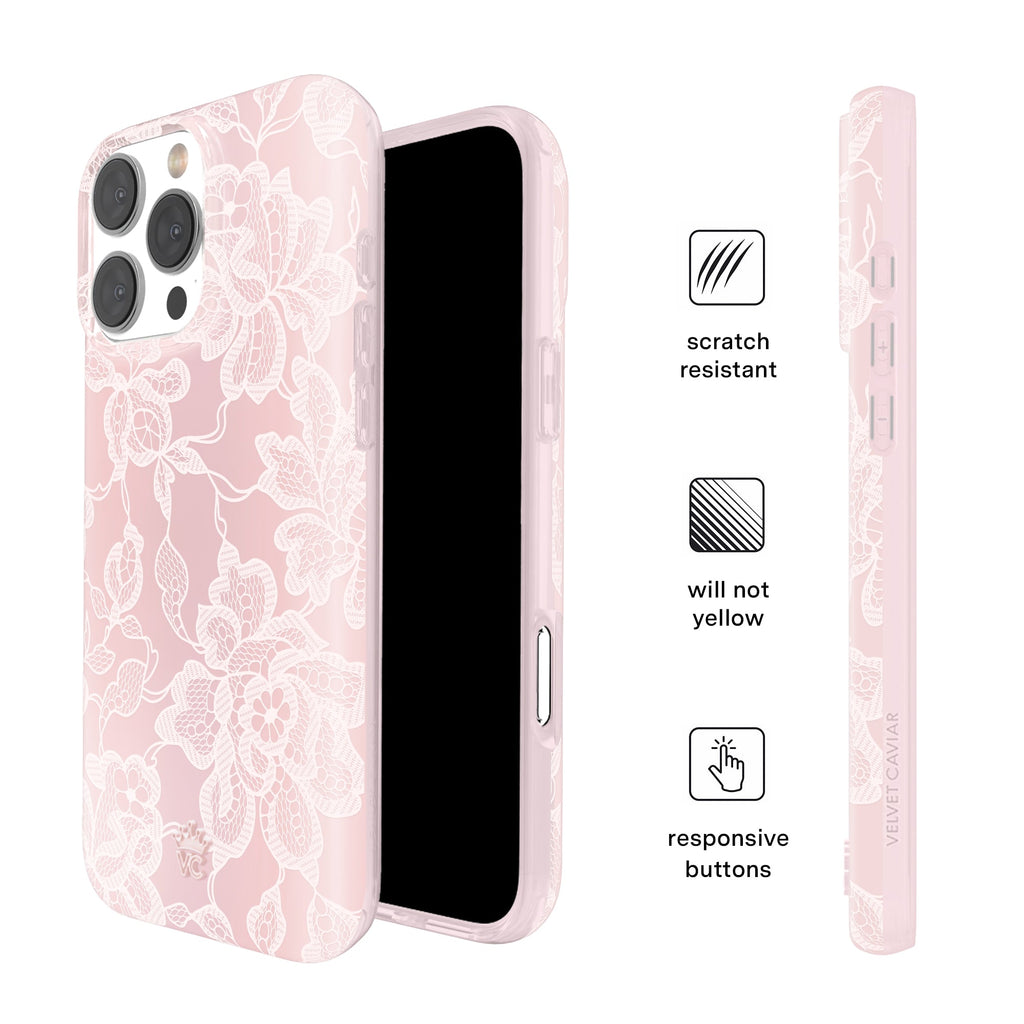 Undress Me Lace iPhone Case