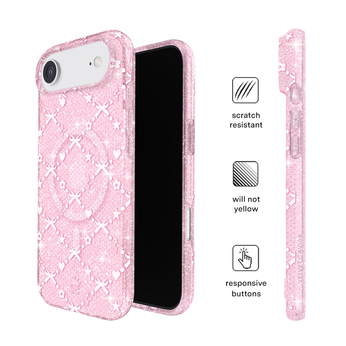 Sugar Baby Glitter iPhone Case