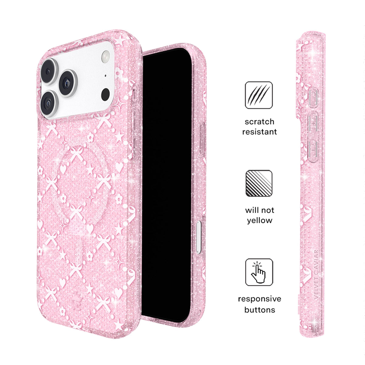 Sugar Baby Glitter iPhone Case