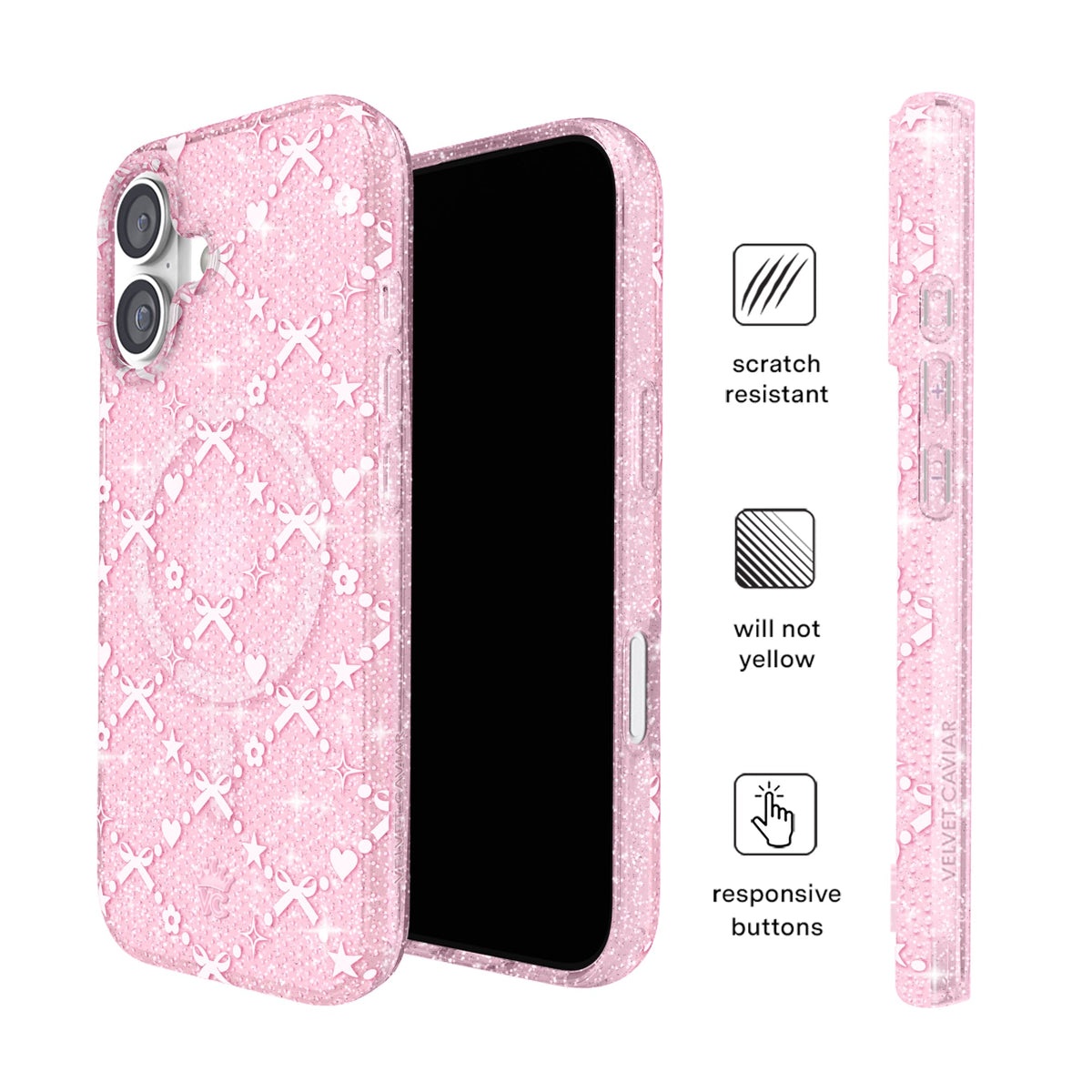 Sugar Baby Glitter iPhone Case